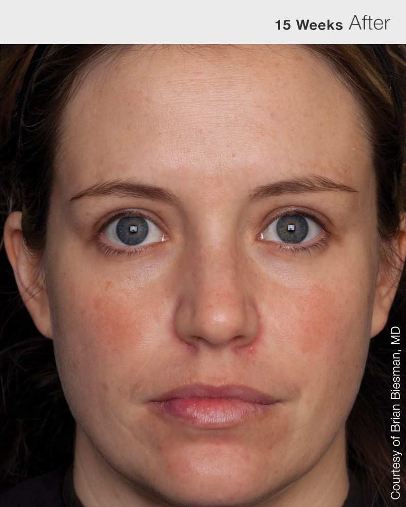 Mass Image Compressor Compressed this image. https://sourceforge.net/projects/icompress/ with Quality:84