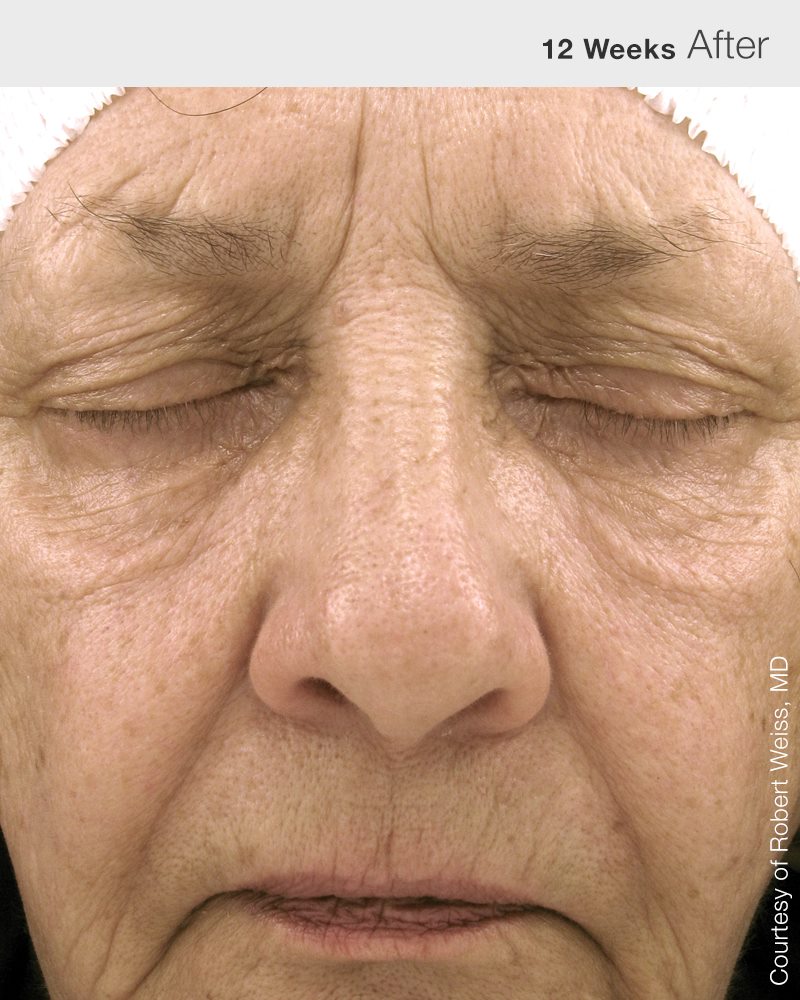 Mass Image Compressor Compressed this image. https://sourceforge.net/projects/icompress/ with Quality:84