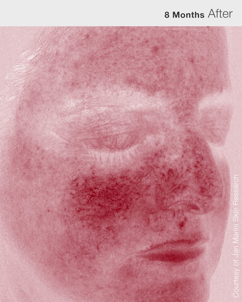 RosaLieve_4Red_HD_after
