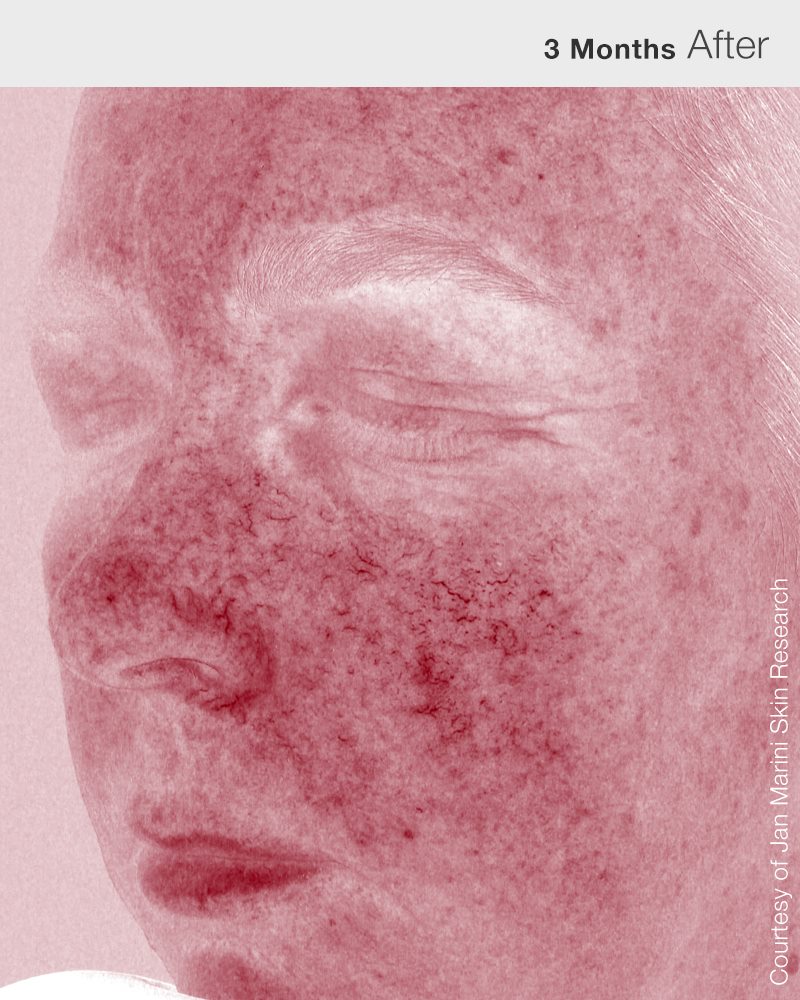 RosaLieve_5Red_HD_after