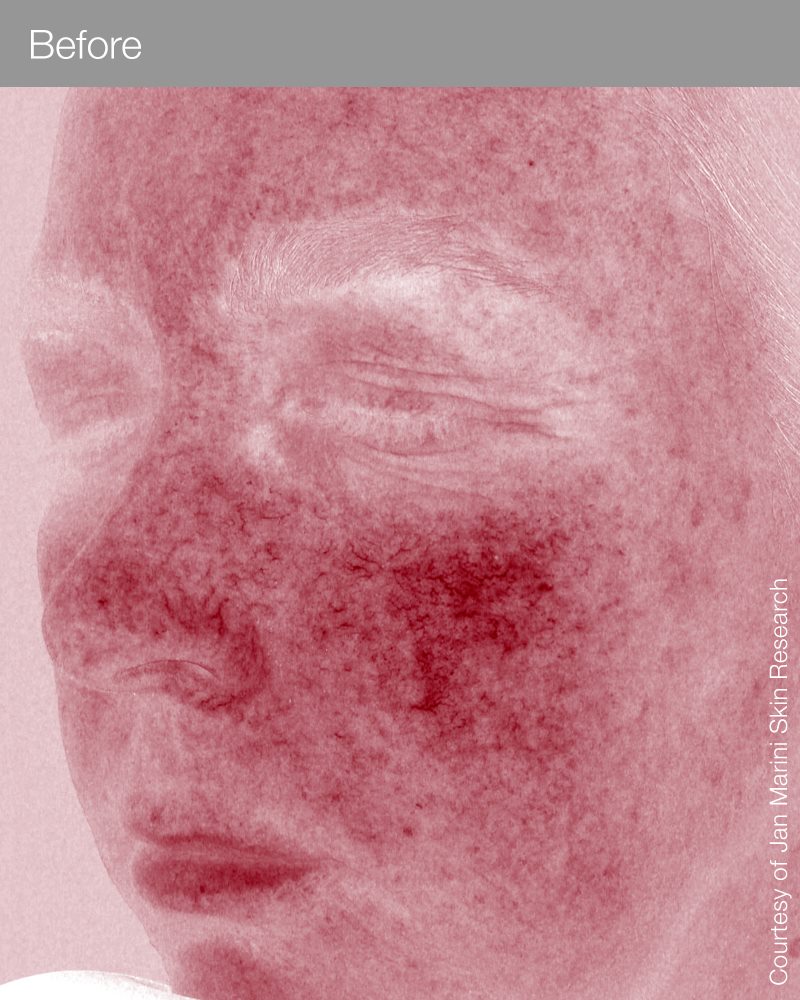 RosaLieve_5Red_HD_before