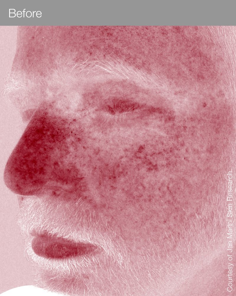 RosaLieve_6_Red_HD_before